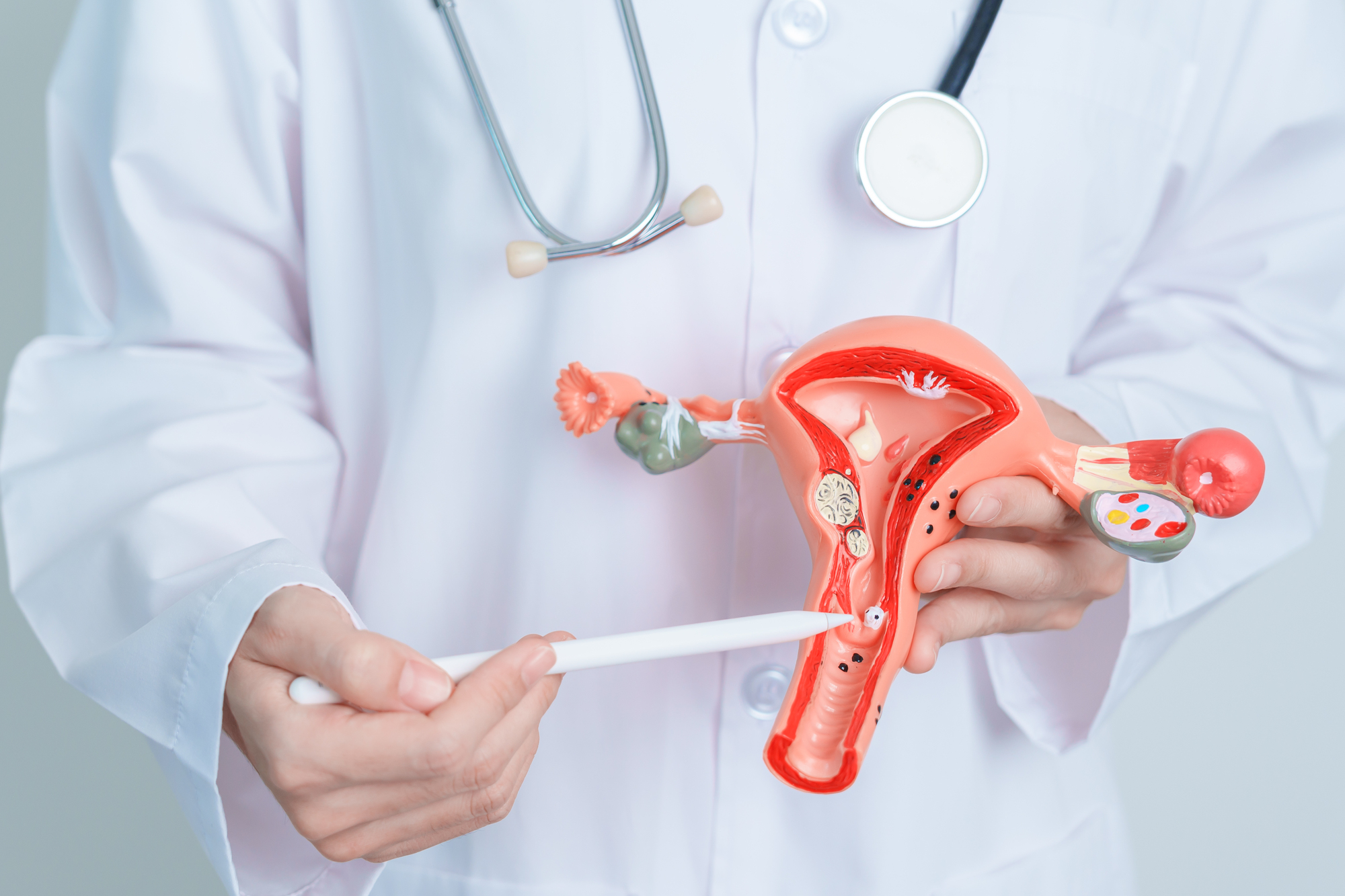 卵巣腫瘍ができると疲れやすい？お腹の出方は？症状・原因・治療│たはらウィメンズクリニック